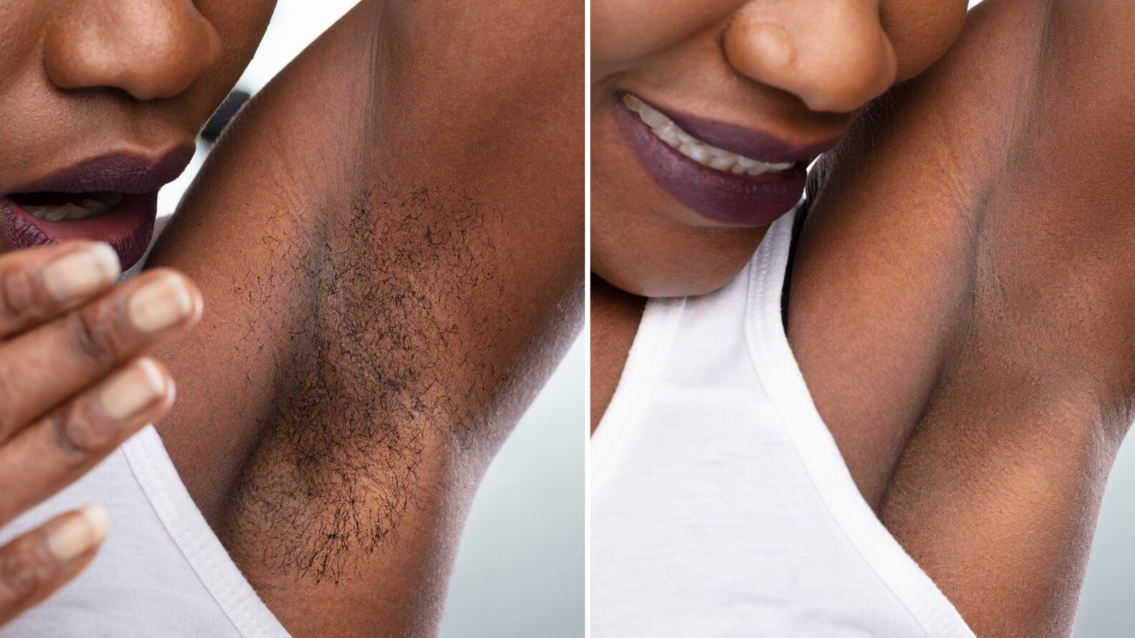 under arm Hair